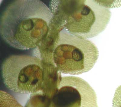 Frullania with rotifers 