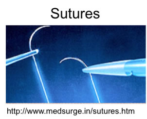 sutures