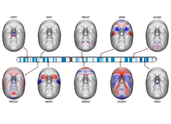 Six faces displayed with the chromosomes associated with different facial features