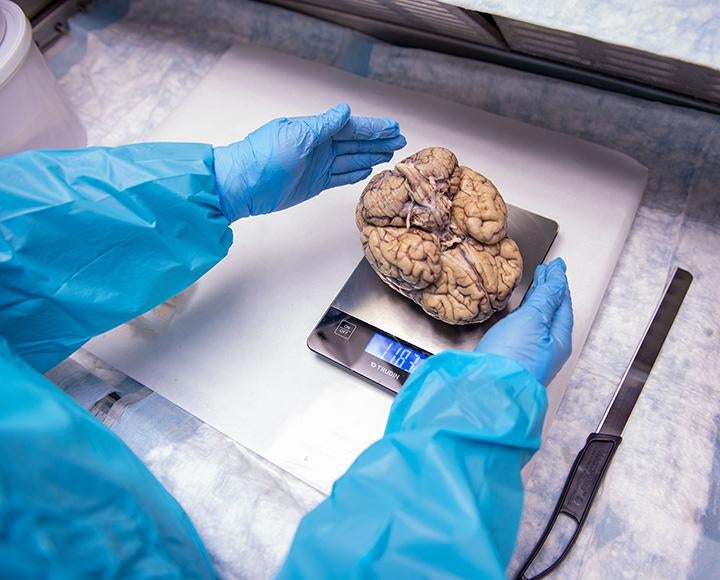Gloved hands place a human brain on a scale