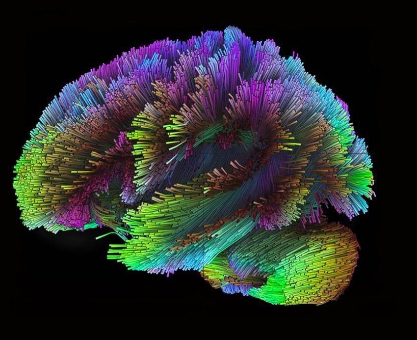 Colorful rendering of human brain