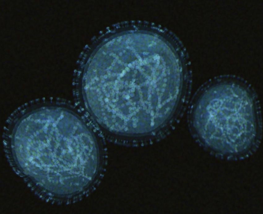a dark image of three blue cells